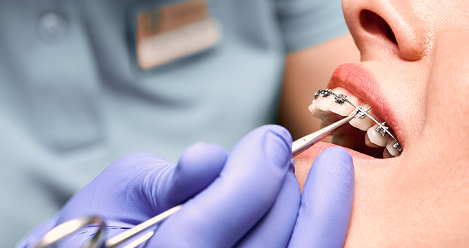 一般的なリスク、副作用